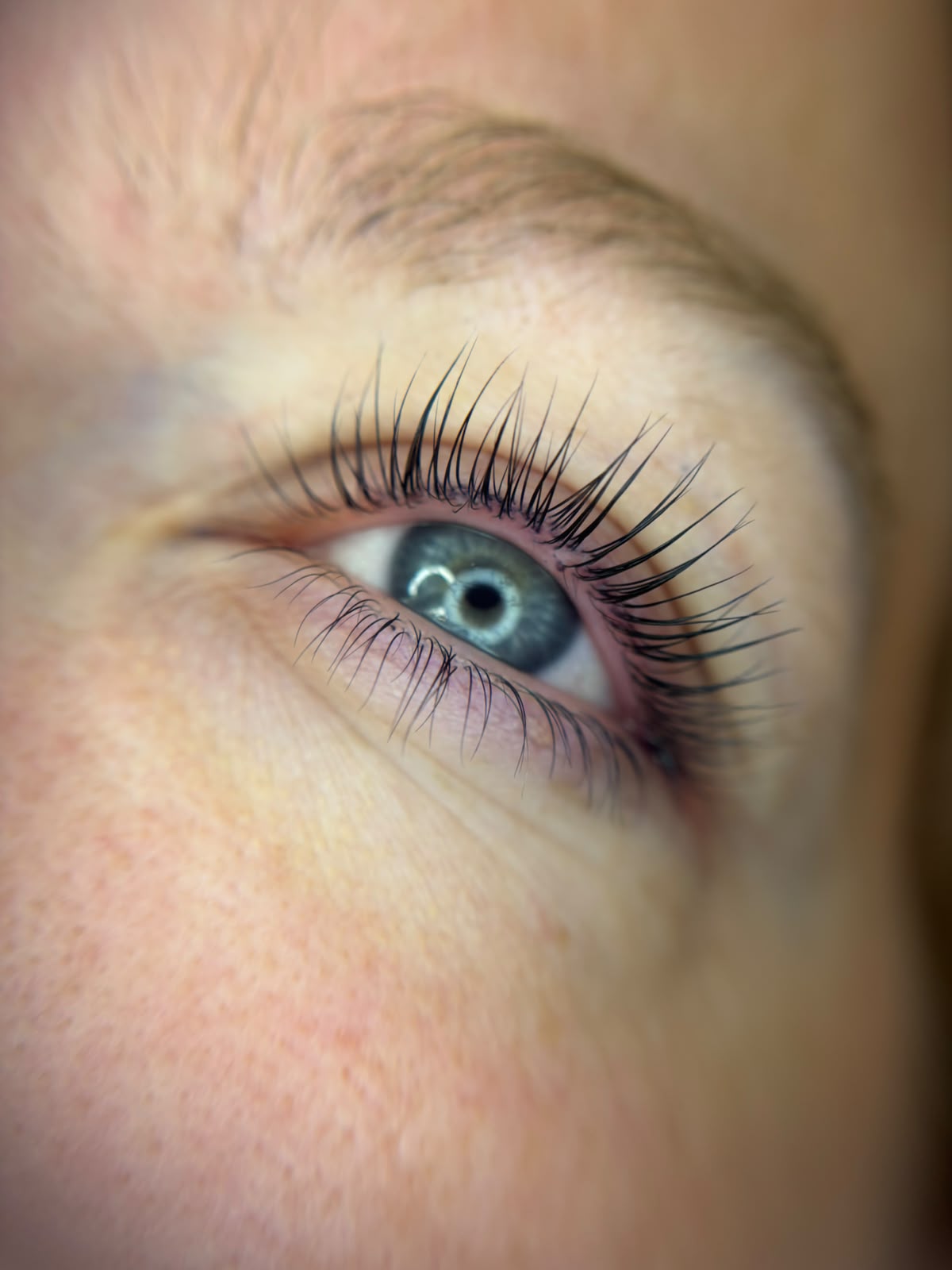 Lippenbehandlung Ergebnis